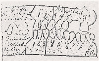 Etchmann’s sketch of Eva Braun’s left side teeth (Keiser-Nielsen & Strøm, 1983) - Histoire de la médecine odontologie médico légale